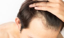 GREFFE CHEVEUX HOMME