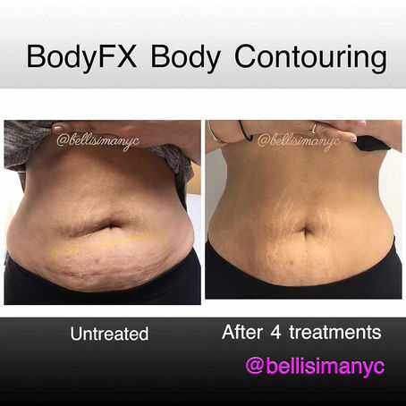 Bodyfx Blast Belly