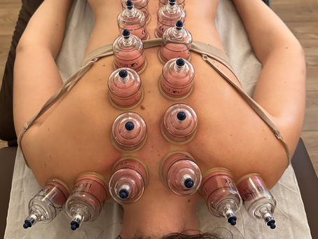 Découvrez l'alliance magique de l'ostéopathie & des ventouses thérapeutiques pour une santé optimale