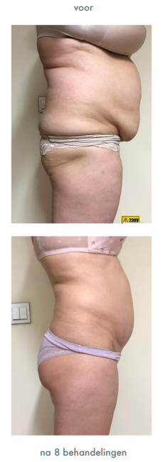 Schermafbeelding 2025-02-19 213642.png