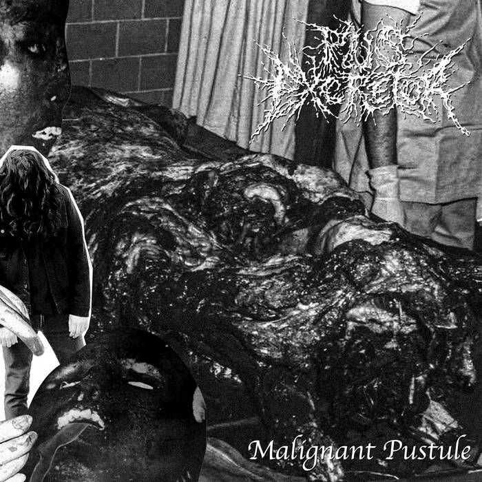 Pus Excretor - Malignant Pustule 7"