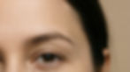 Botox e Preenchimentos