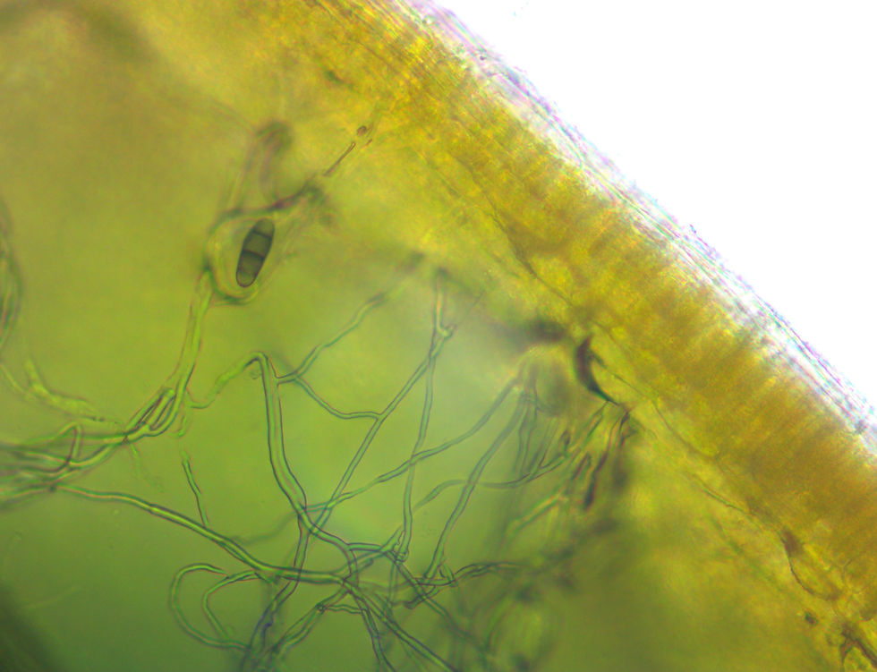 Rhizoctonia Blight image