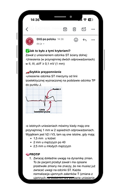 EKG Express, nauka EKG, interpretacja EKG, ekg po polsku, ekgpopolsku