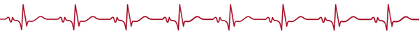 ekg, załamki EKG