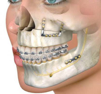 ortothumbnail-350x350.jpg