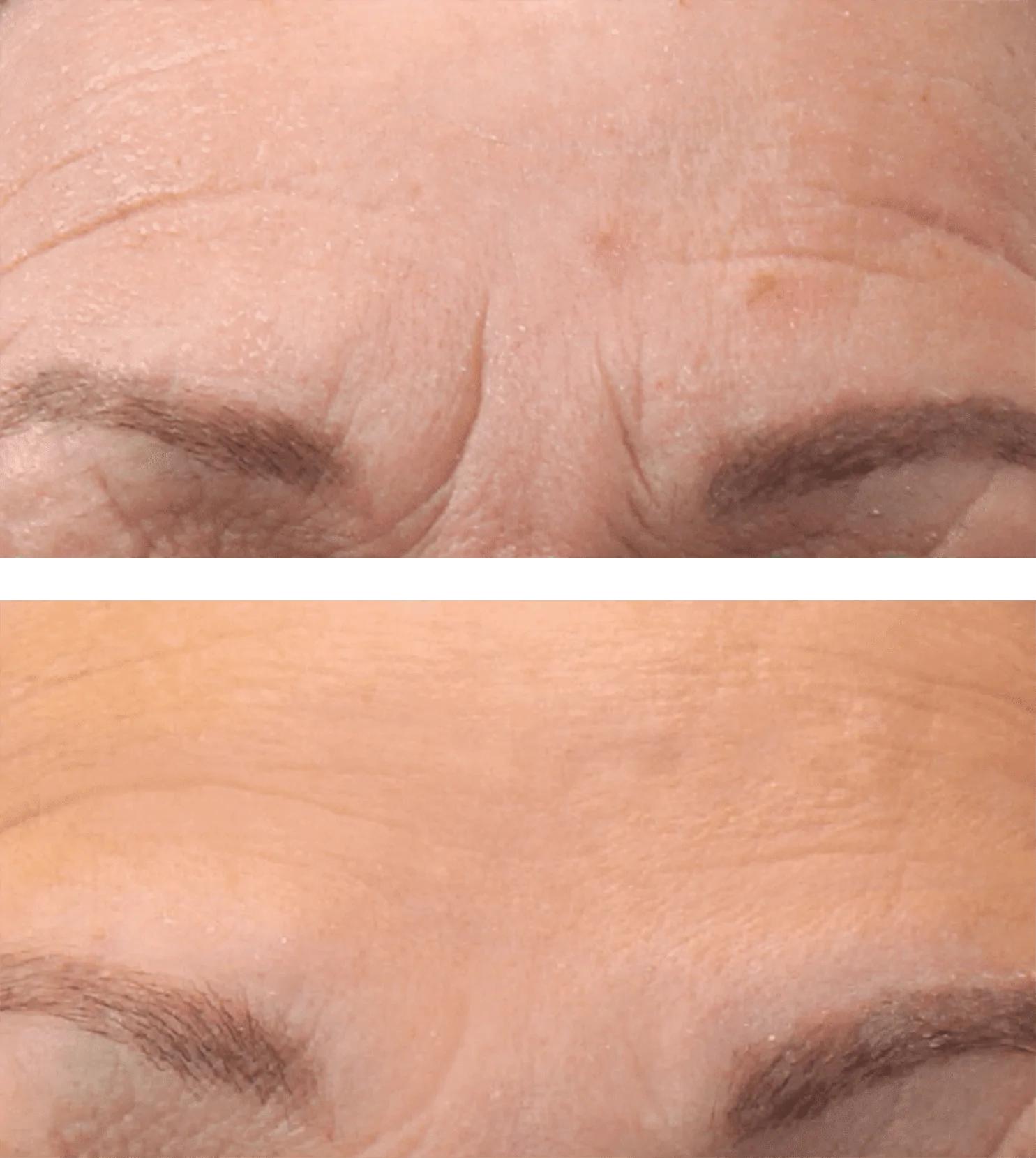 iS Clinical Gesichtsbehandlung Hamburg Hydrafacial Dermatude Meta Therapie Liposana3 dauerhafte Haarentfernung