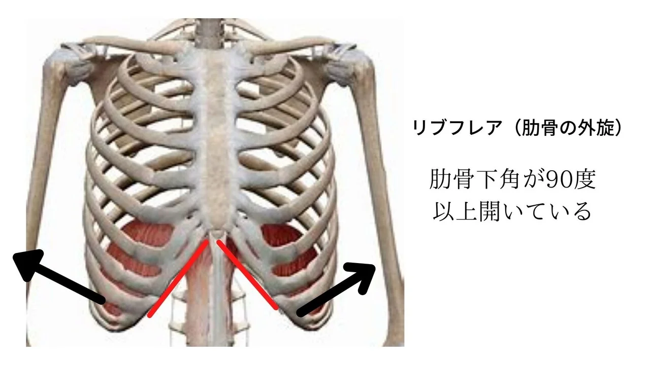 リブフレアの状態