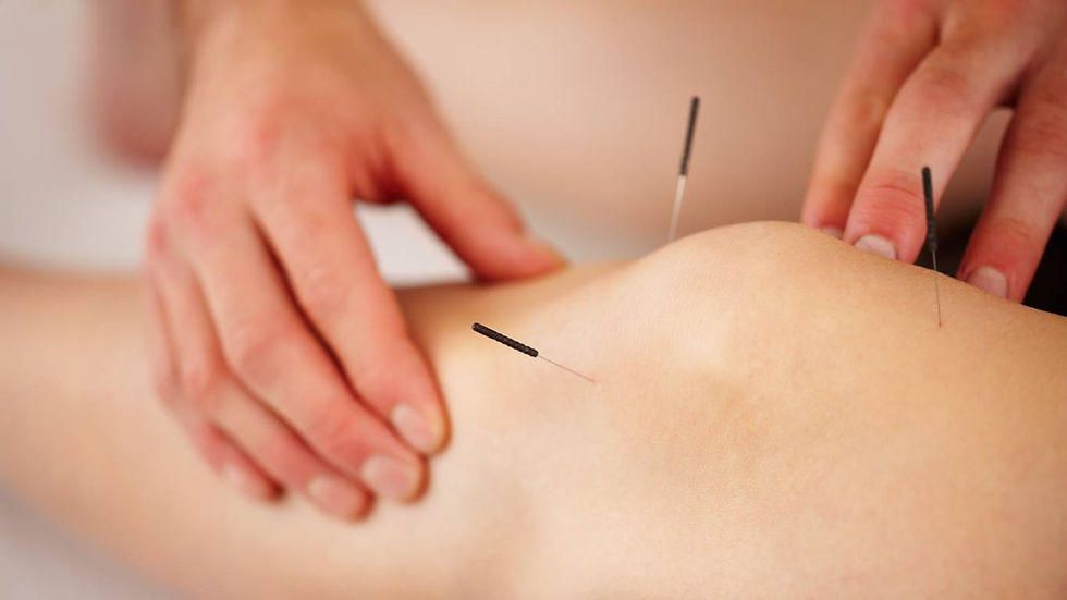 Dry-needling