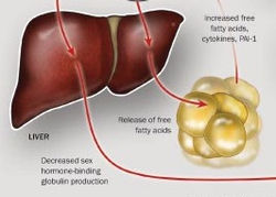 Fatty Liver Disease