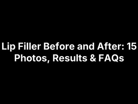 Lip Filler Before and After: 15 Photos, Results & FAQs