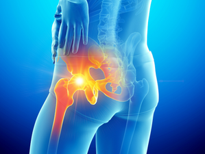 Tumores ósseos e histórico familiar: informação e prevenção