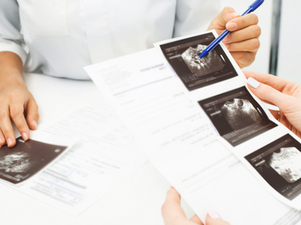 Dia Mundial do Câncer de Ovário: tire suas dúvidas