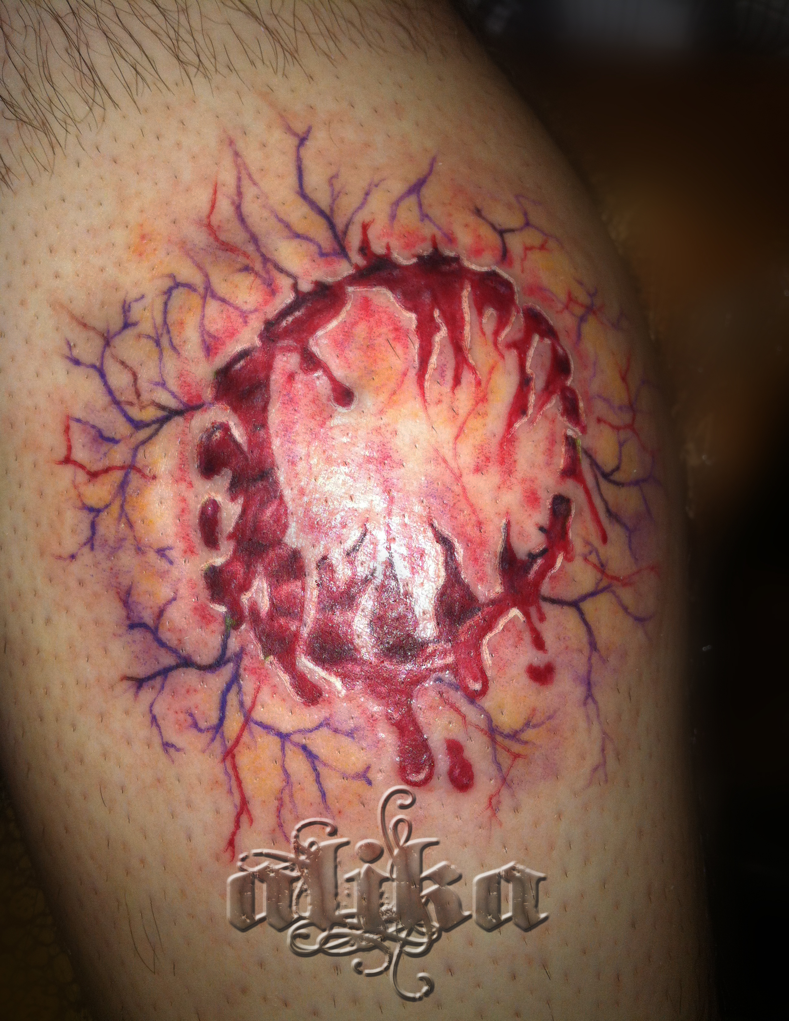 Zombie bite