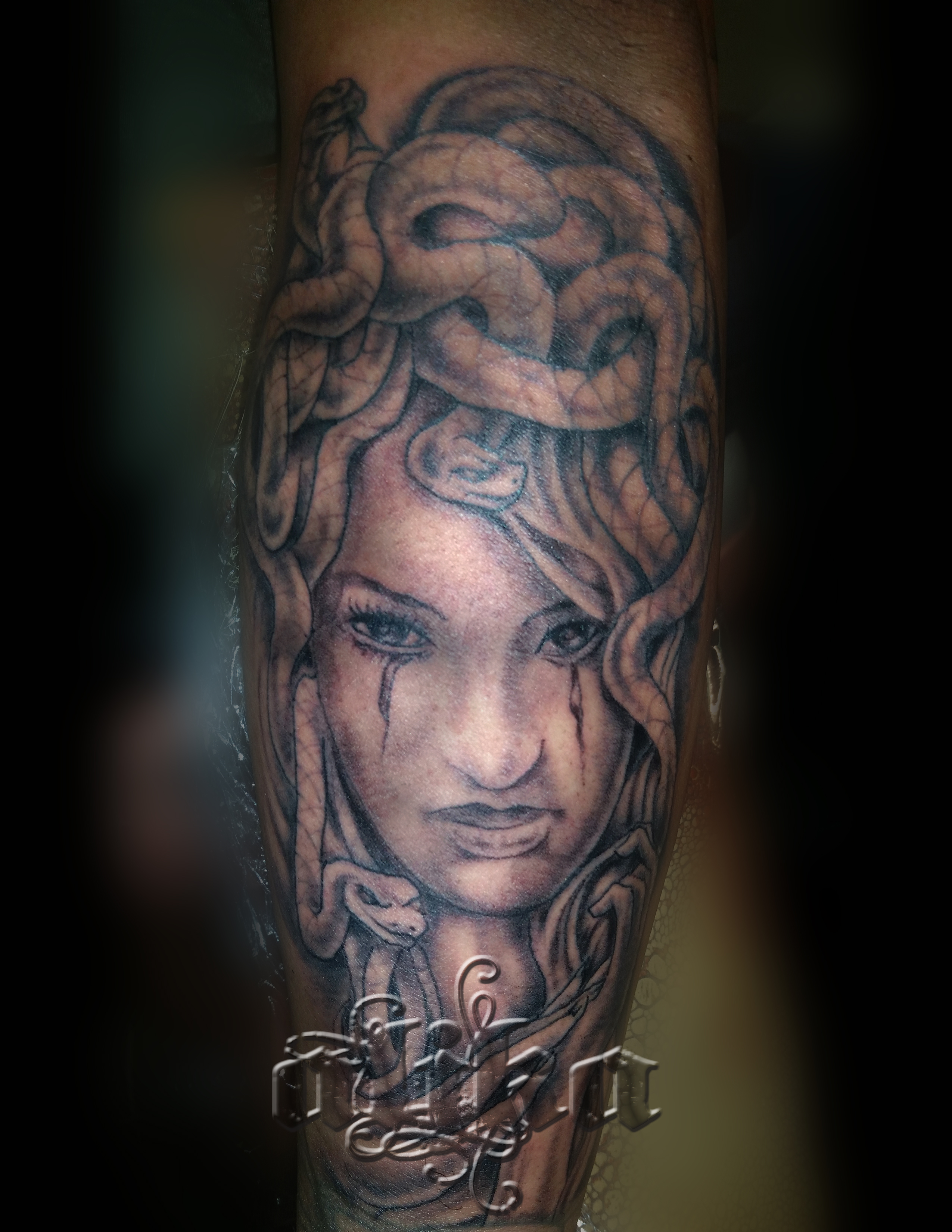 Medusa