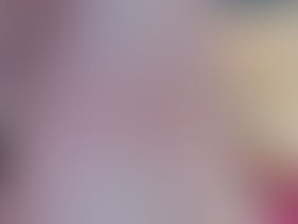 How Hypermobility, EDS and Lyme Disease Connect