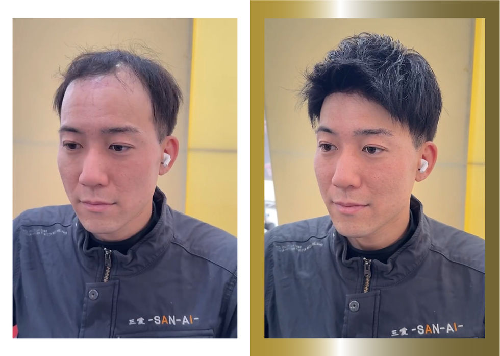 b&a6