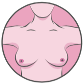 Self breast exam - step 1