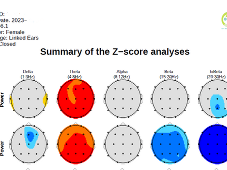 Neurofeedback: neuroprotección ante el deterioro cognitivo leve asociado con riesgo de Alzheimer