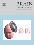 BrainStim Cover.gif