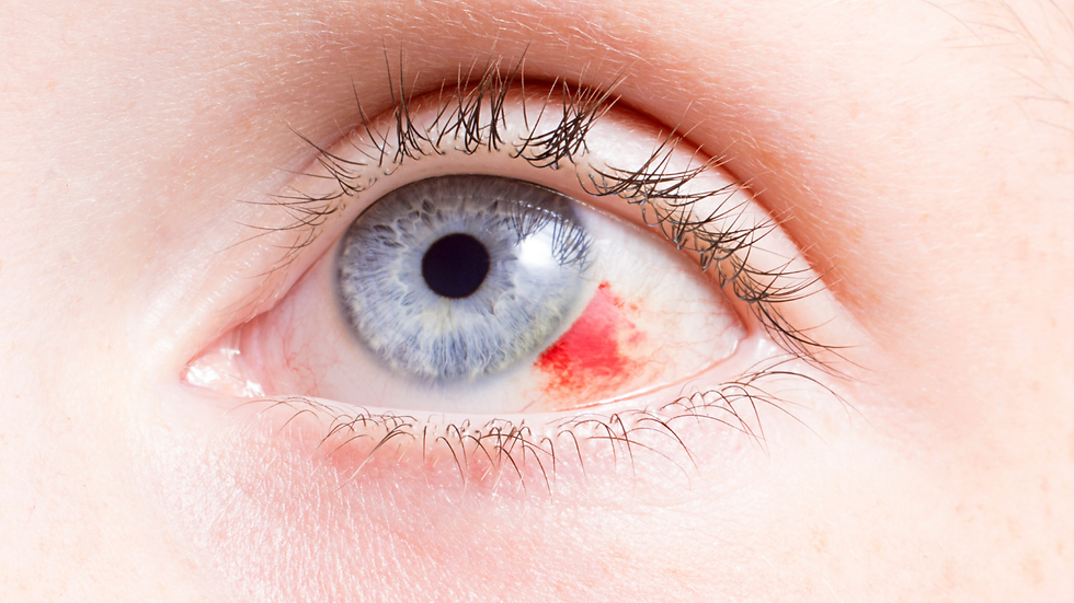Worker wearing protective eyewear to prevent workplace eye injuries