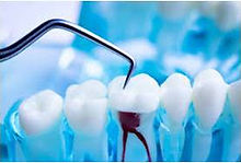 ENDODONCIA 1.jpg