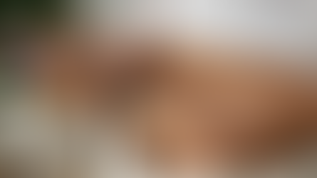 Pancreatite aguda e canetas emagrecedoras: o que você precisa saber