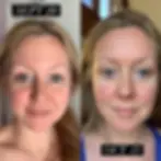 before after results