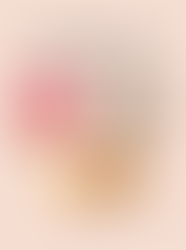 3 dicas de Queijos, Leite e Chocolate possíveis para Hidradenite