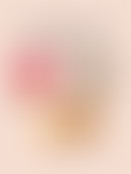 3 dicas de Queijos, Leite e Chocolate possíveis para Hidradenite