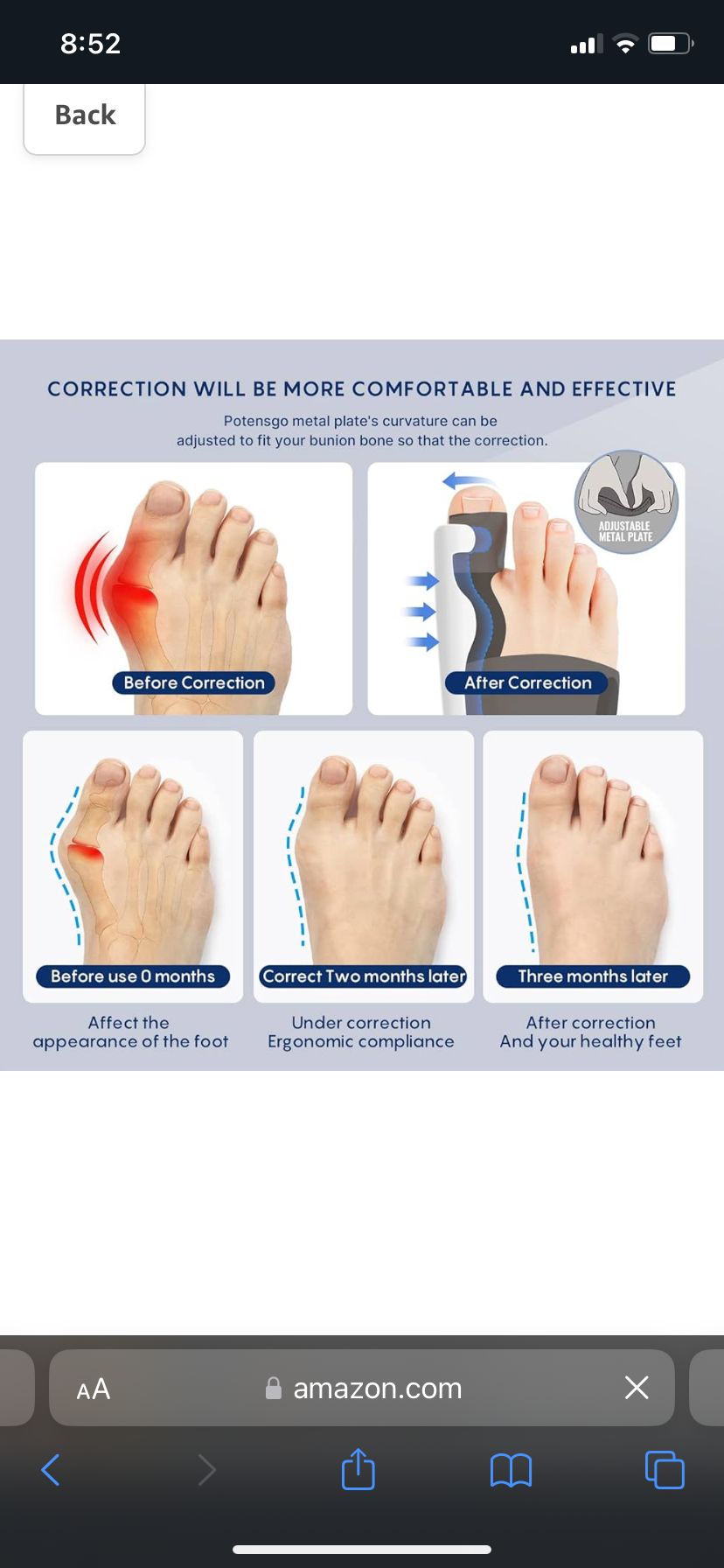 Thumbnail: Trend Vision Bunion Corrector 
