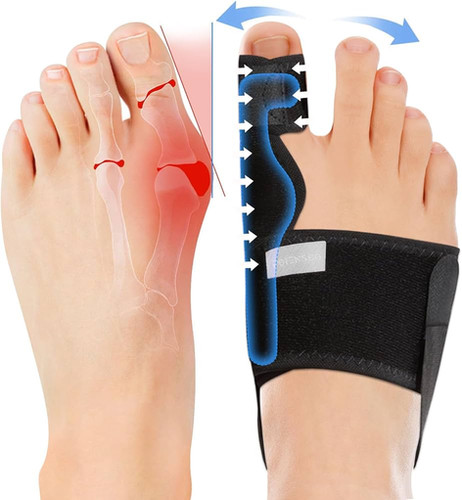 Trend Vision Bunion Corrector