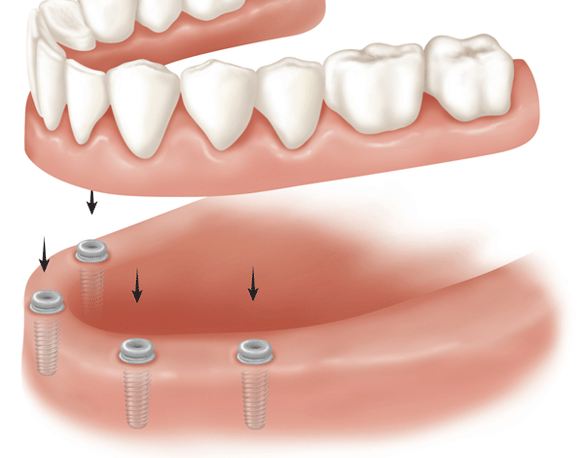 Dr John Khodarahmi, Modbury North Dentist, JK Dental