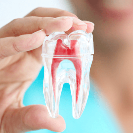 endodoncia.png
