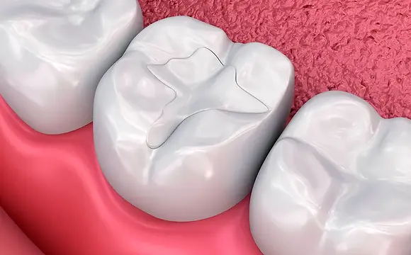 29.-Empaste-dental.webp