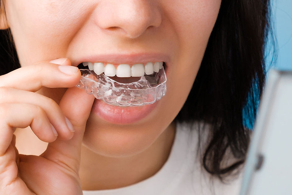 retenedores dentales
