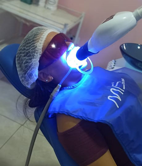 Blanqueamiento dental.jpeg