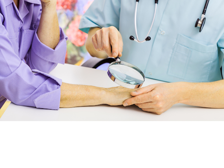 Exploring the Unique Characteristics of Different Types of Psoriasis