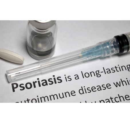 The Emotional Impact of Psoriasis: Coping Strategies and Support Resources