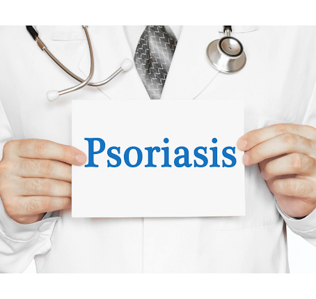 Psoriasis Research and Breakthroughs: The Latest Developments in Treatment and Understanding