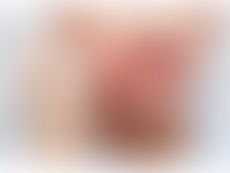 Psoriasis in Children: Diagnosis, Treatment, and Support for Pediatric Patients