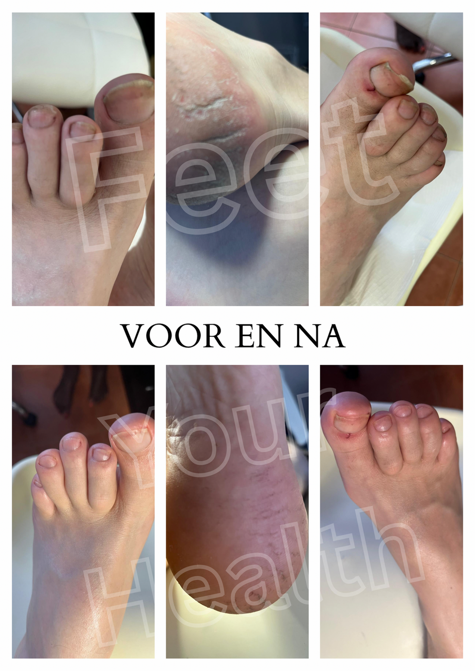 Voetverzorging Behandeling Showcase