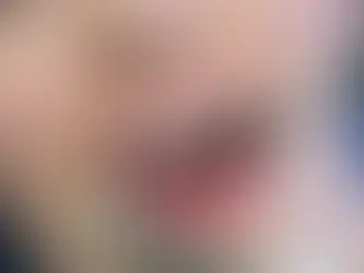 how to get rid of plaque