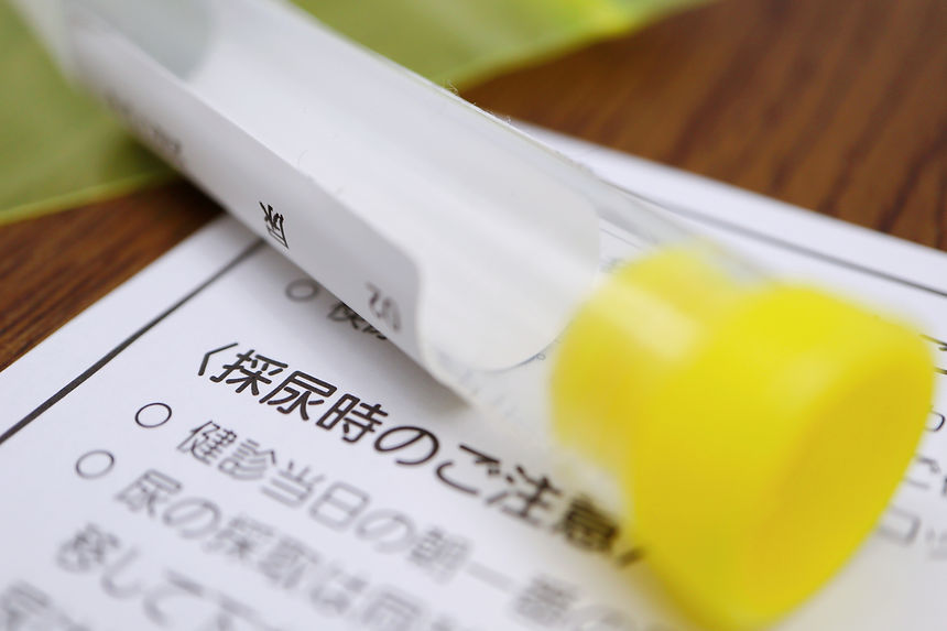 検尿