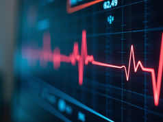 5 Critical Reasons Why You Need a Heart Rate Variability Test for a Healthy Heart and Longer Life