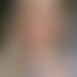 Chromosome 22q12 Encodes Merlin to Inhibit Tumour Growth — I Lack Merlin, Not Magic.