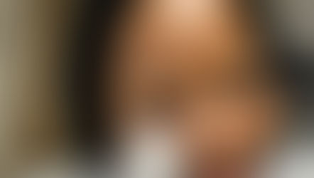 Living With Trigeminal Neuralgia – My 10-Year Journey