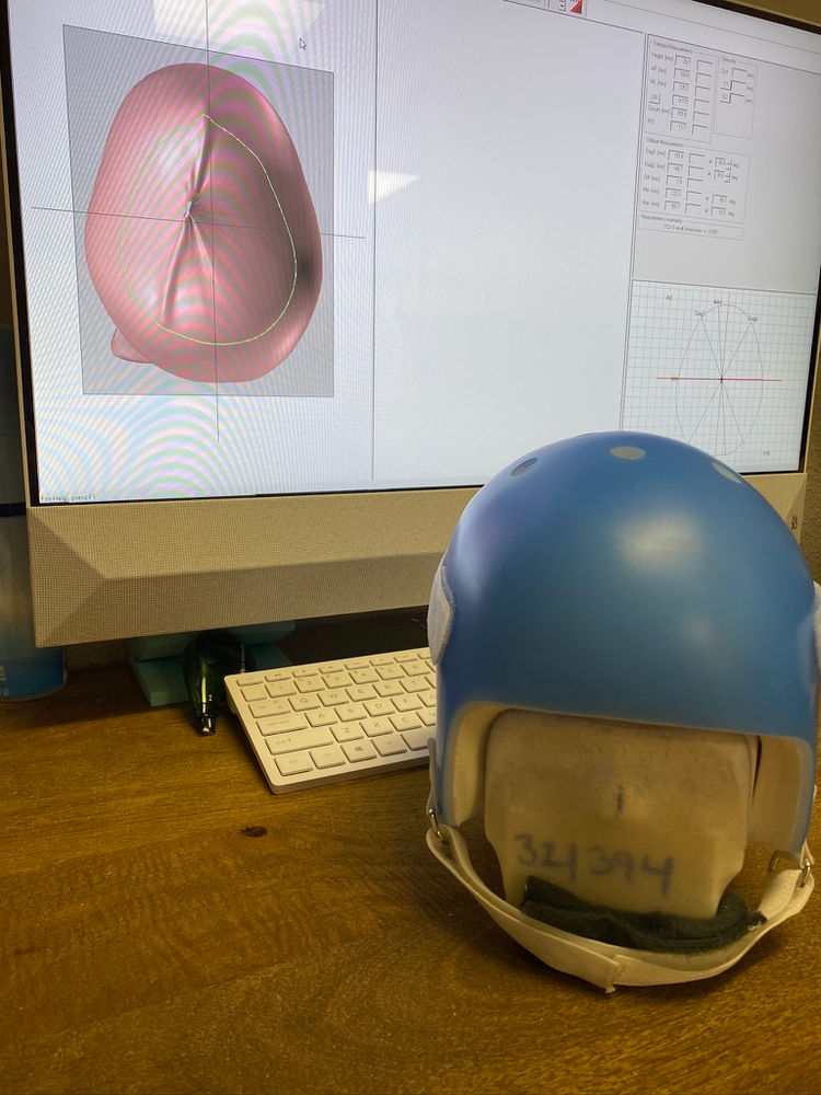 Custom Protective Helmets