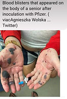 Blood Blisters.jpg