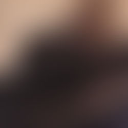 Rob, Unconscious